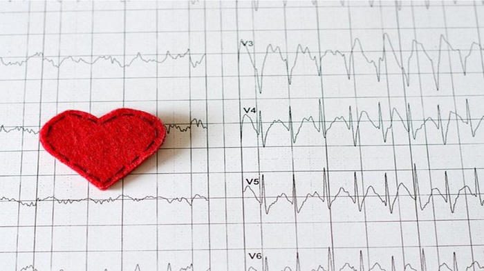 آریتمی قلبی چیست و انواع آن کدام اند؟
