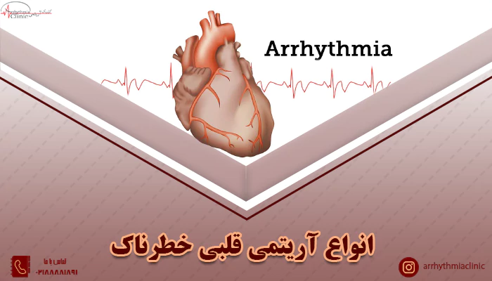 بررسی انواع آریتمی‌ قلبی خطرناک