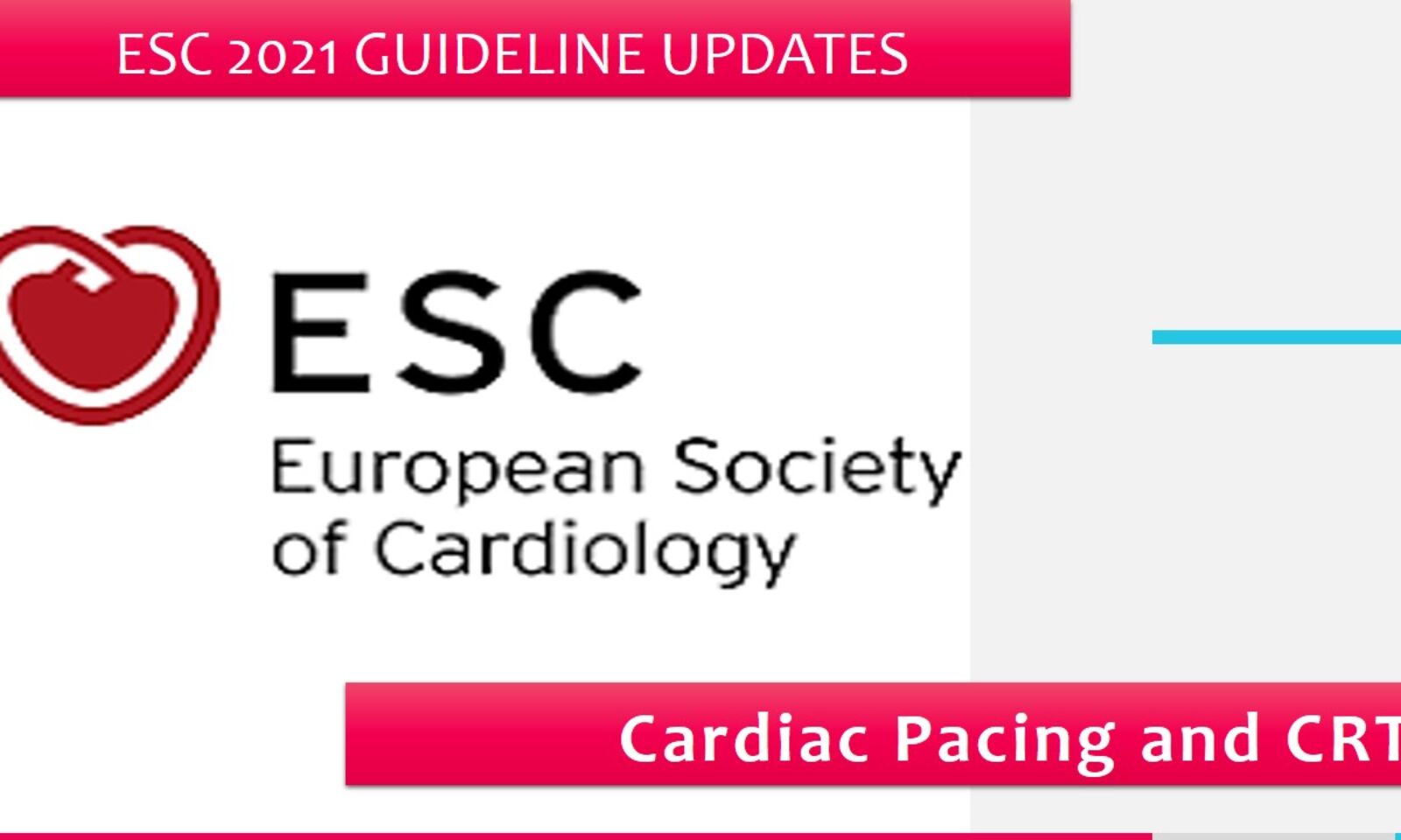 ESC-guideline-on-cardiac-pacing