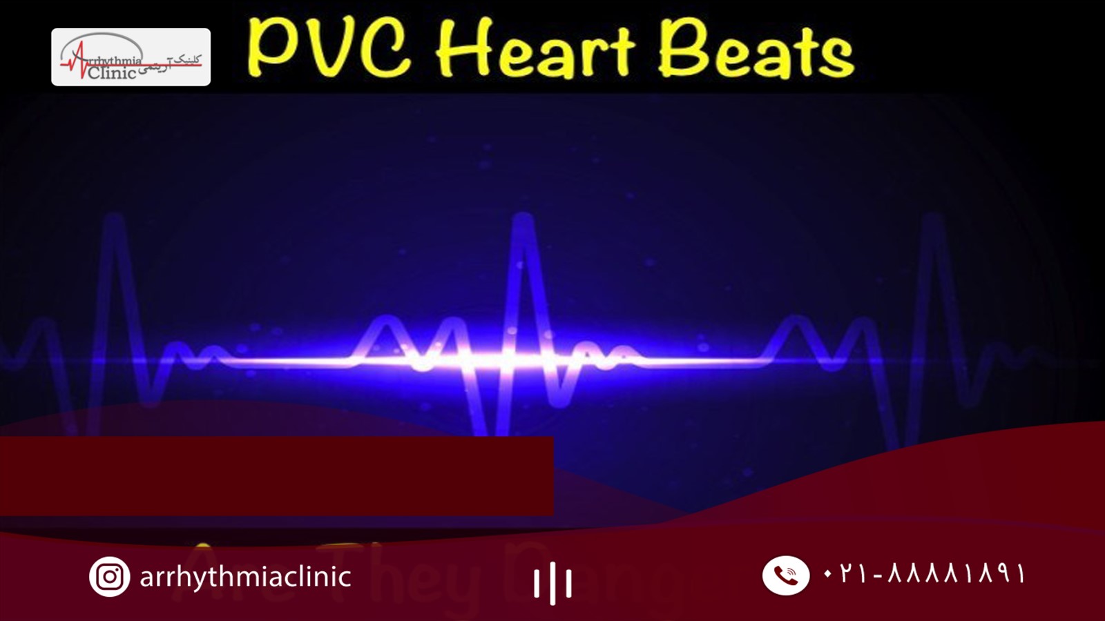 آریتمی قلبی PVC به چه دلایلی به وجود می آید