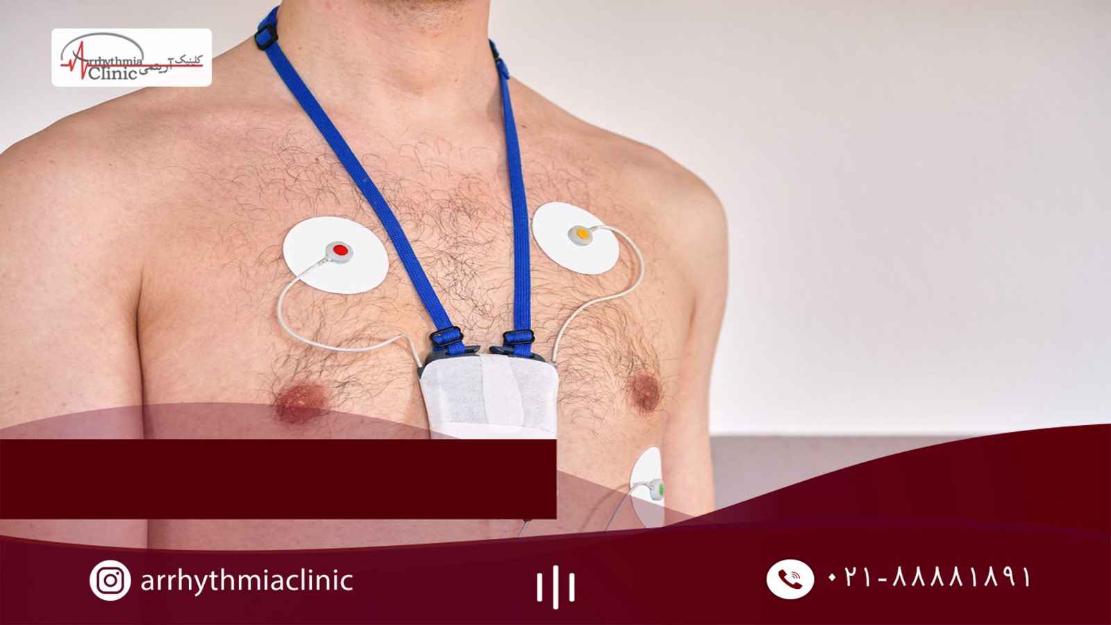 استفاده از هولتر برای تشخیص آریتمی قلبی PVC