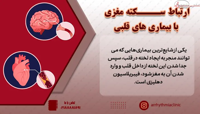 ارتباط سکته مغزی با بیماری های قلب و عروق