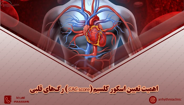 شاخصه های تعیین کردن اسکور کلسیم (CAC score ) رگ‌های قلبی
