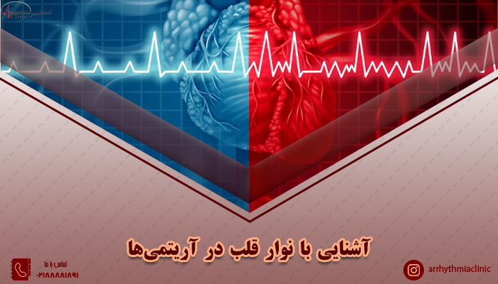 روش خواندن نوار قلب در آریتمی ها و آشنایی با انواع نوار قلب مرتبط با آریتمی های قلبی | کلینیک توانیر آریتمی