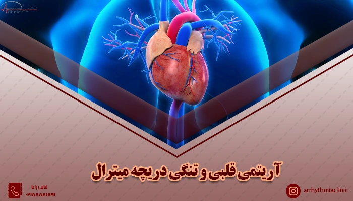 ارتباط بین تنگی دریچه میترال و آریتمی قلبی در کلینیک آریتمی توانیر