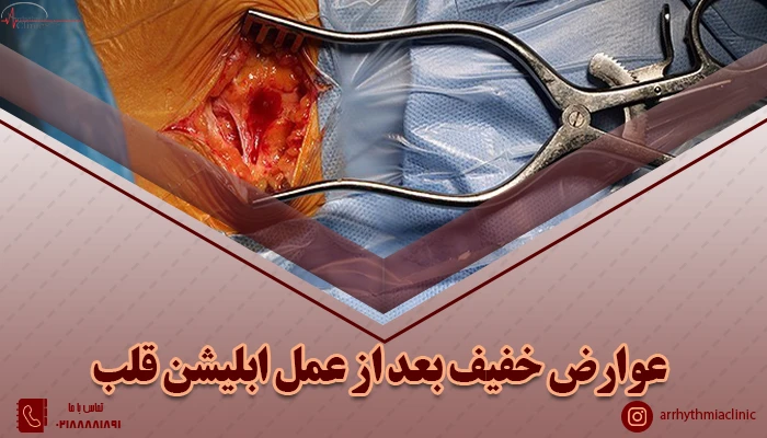 همه چیز درباره عوارض خفیف بعد از عمل ابلیشن قلب در کلینیک آریتمی توانیر تهران