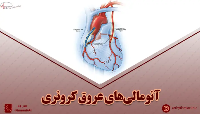 آنومالی‌های عروق کرونری