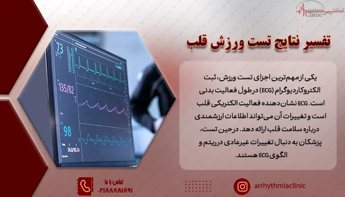 تفسیر نتایج تست ورزش قلب با تحلیل الکتروکاردیوگرام