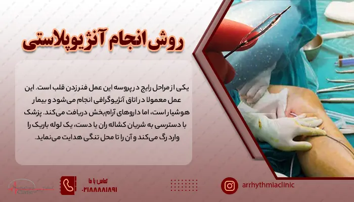 روش انجام آنژیوگرافی به این صورت است که پس از آماده کردن بیمار و هدایت لوله از طریق ران یا دست بالون زنی انجام و سپس فنرزدن قلب انجام می شود.