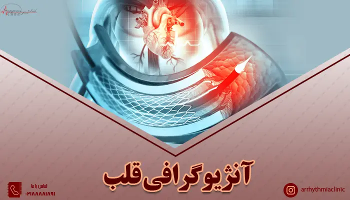 بررسی کامل روش آنژیوگرافی قلب