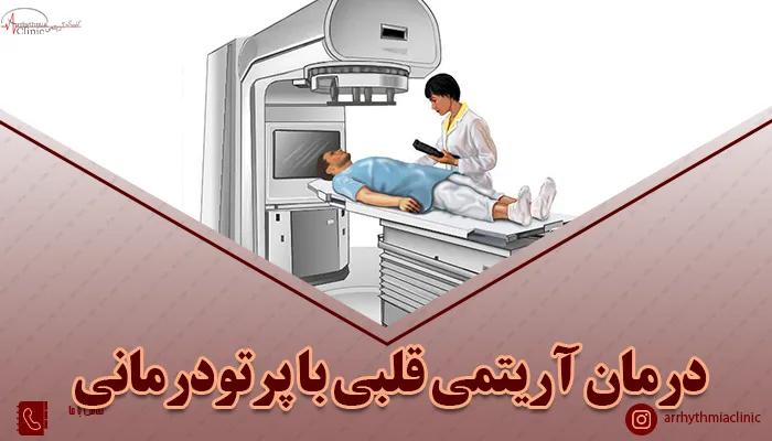 درمان آریتمی قلبی با پرتودرمانی چگونه انجام میشود؟