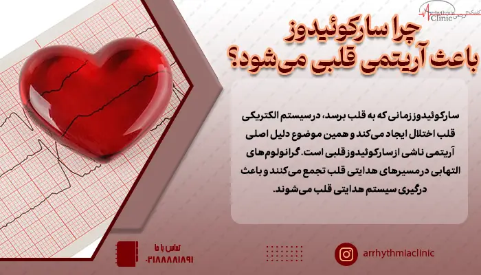 گرانولوم‌های التهابی در مسیرهای هدایتی قلب تجمع می‌کنند و این باعث آریتمی ناشی از سارکوئیدوز قلبی می‌شوند.